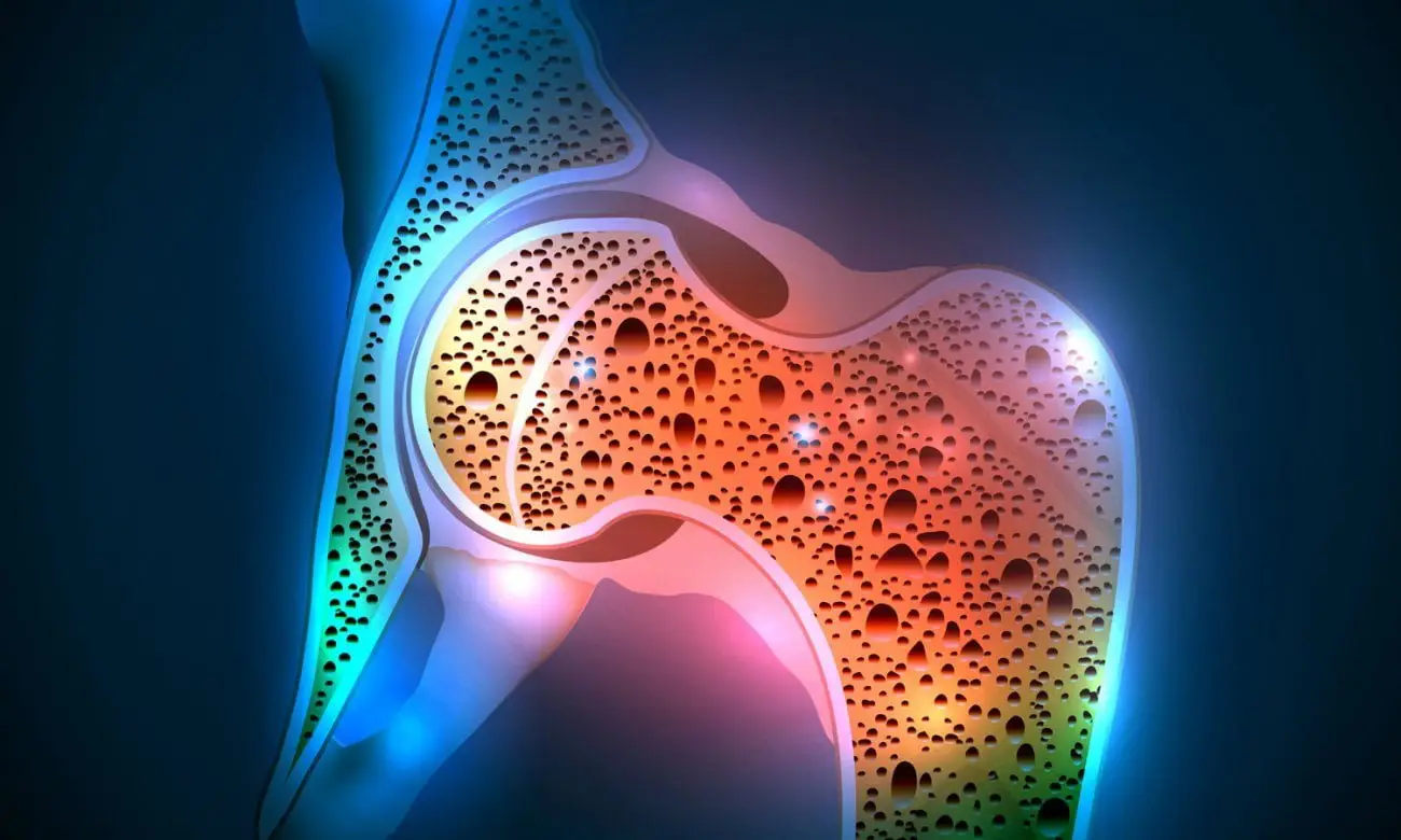 El tratamiento natural que reduce el riesgo de osteoporosis según nuevos estudios